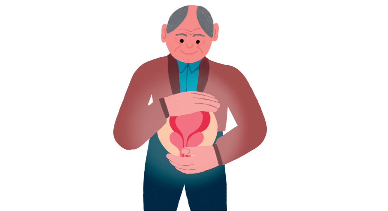 ¿Cómo puede matar una biopsia de próstata?